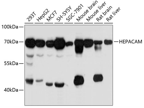 Anti-HEPACAM Antibody (CAB11589)