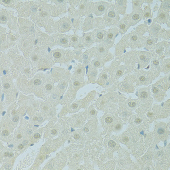 Anti-PHOX2B Polyclonal Antibody (CAB9685)