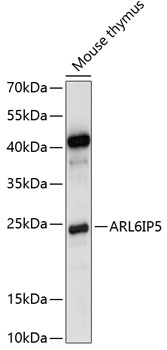 Anti-ARL6IP5 Antibody (CAB14842)