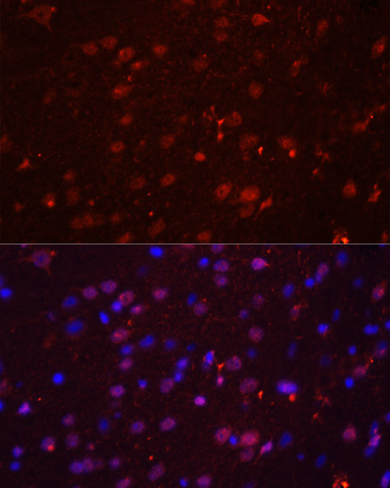 Anti-GRIN2B Antibody (CAB3056)