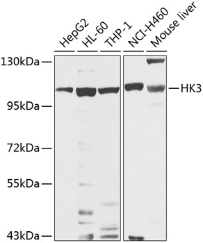 Anti-Hexokinase-3 Polyclonal Antibody (CAB8428)