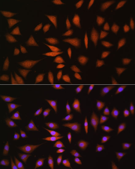 Anti-NRBF2 Antibody (CAB6462)