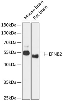 Anti-EFNB2 Antibody (CAB12961)