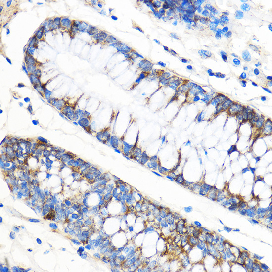 Anti-ATG5 Antibody (CAB0203)