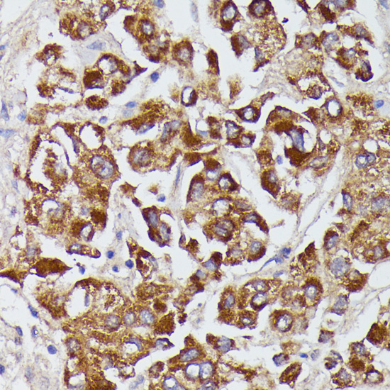 Anti-AGT Antibody (CAB15637)