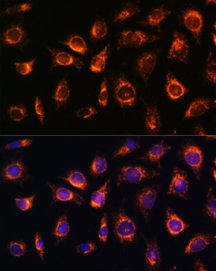 Anti-RAB1A Antibody (CAB17364)