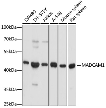 Anti-MADCAM1 Antibody (CAB3005)