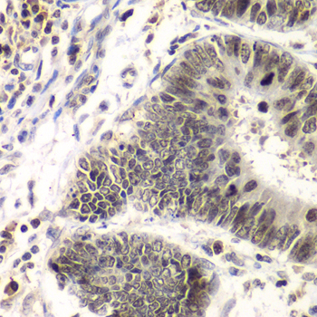 Anti-SMARCA4 Antibody [KO Validated] (CAB0887)