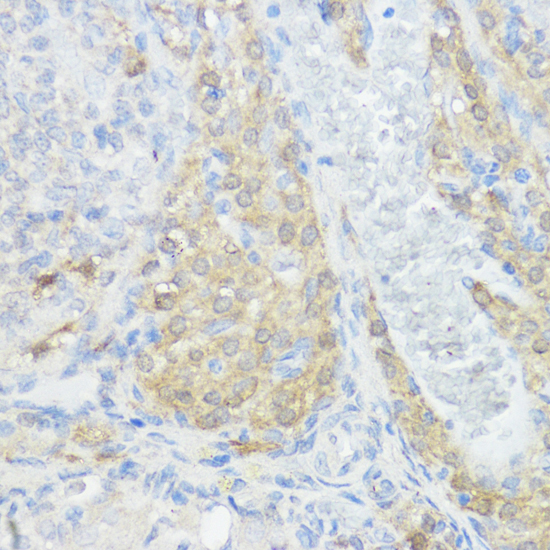 Anti-NOD1 Antibody (CAB1246)