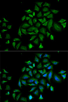 Anti-FGFR1 Antibody (CAB13493)