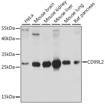 Anti-CD99L2 Antibody (CAB15907)