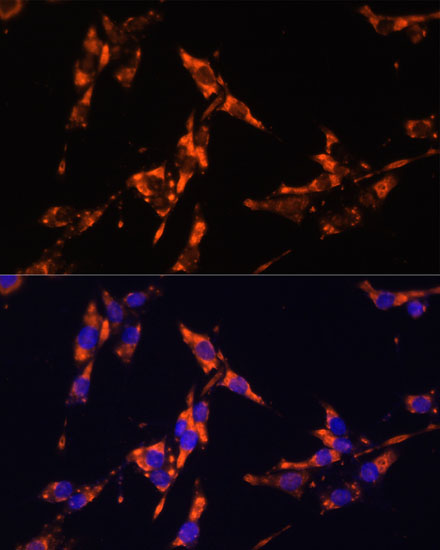 Anti-IL-18 Antibody (CAB16737)