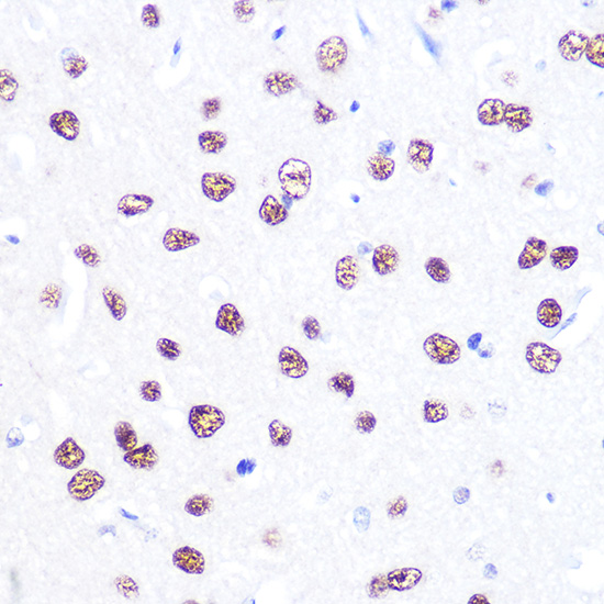 Anti-ATF2 Antibody [KO Validated] (CAB2155)