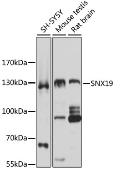 Anti-SNX19 Antibody (CAB5229)