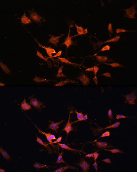 Anti-KEAP1 Antibody (CAB17062)