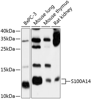 Anti-S100A14 Antibody (CAB10394)