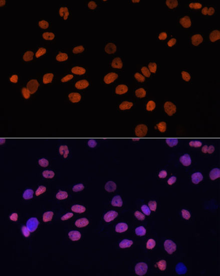 Anti-GATA4 Mouse Monoclonal Antibody (CAB3600)