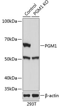 Anti-PGM1 Antibody [KO Validated] (CAB19904)