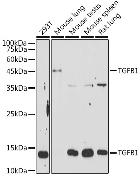 Anti-TGFB1 Antibody (CAB15103)