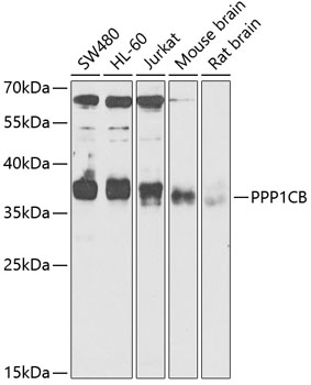 Anti-PPP1CB Antibody (CAB13528)