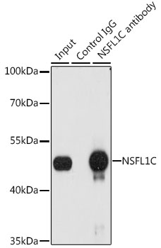 Anti-NSFL1C Antibody (CAB6677)