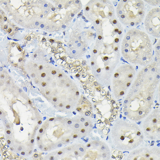 Anti-KPNA3 Polyclonal Antibody (CAB8347)