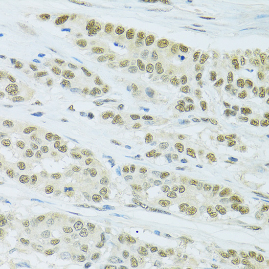 Anti-FIP1L1 Antibody (CAB7138)