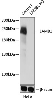 Anti-LAMB1 Antibody [KO Validated] (CAB19970)