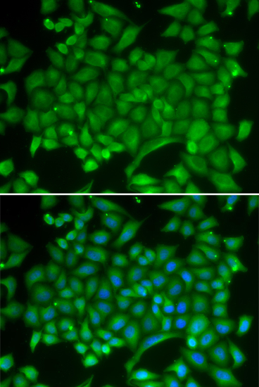 Anti-RAB11A Antibody (CAB1167)