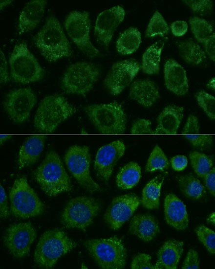 Anti-MAP3K1 Antibody (CAB16057)