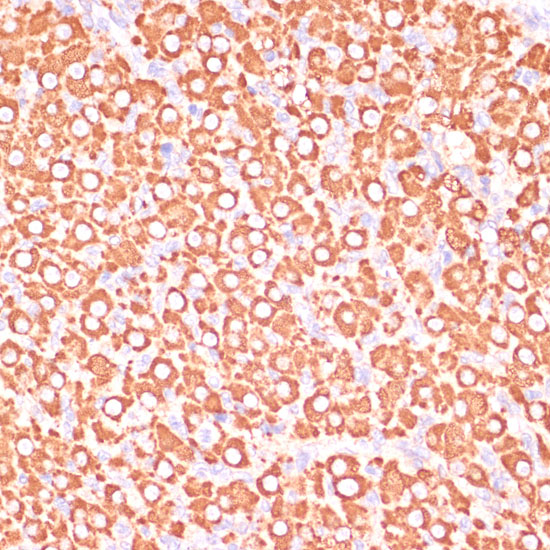 Anti-MAP2K3 Antibody (CAB7718)