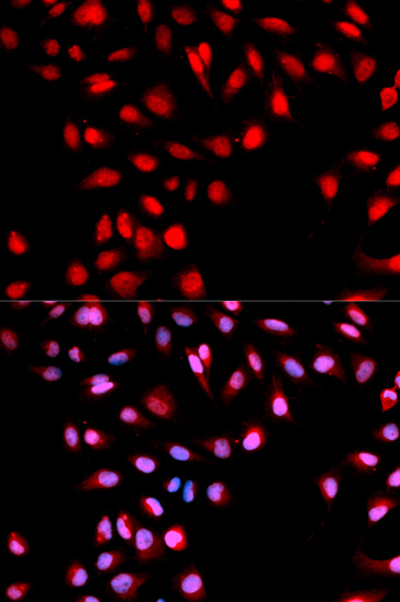 Anti-Phospho-MET-Y1003 Antibody (CABP0076)