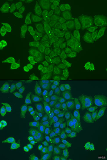 Anti-DPM1 Antibody (CAB7757)