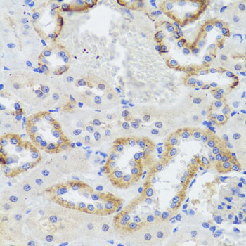 Anti-Synaptopodin Polyclonal Antibody (CAB8484)