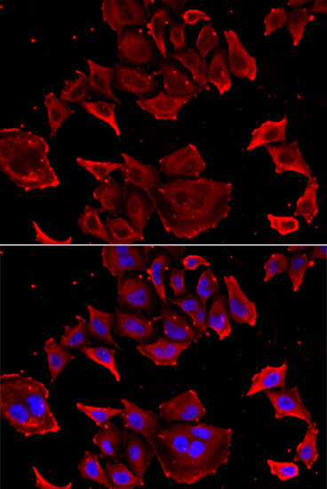 Anti-TCAP Antibody (CAB13566)