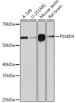 Anti-PSMD4 Antibody (CAB3663)