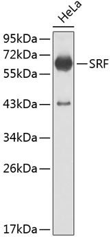 Anti-SRF Antibody (CAB0409)