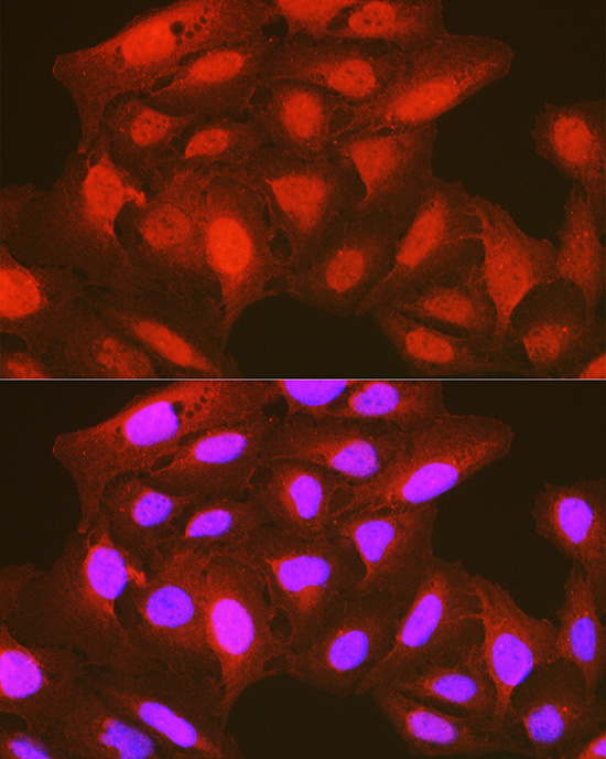 Anti-Phospho-PDK1-S241 Antibody (CABP0477)