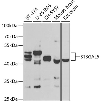 Anti-ST3GAL5 Antibody (CAB7947)