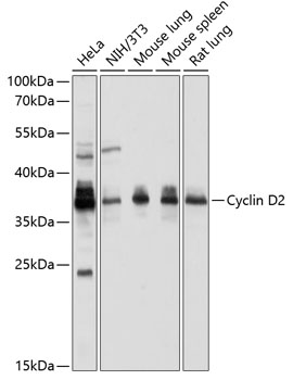 Anti-Cyclin D2 Antibody (CAB1773)