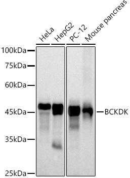 Western blot analysis of extracts of various cell lines, using BCKDK antibody at 1:500 dilution. Secondary antibody: HRP Goat Anti-Rabbit IgG (H+L) at 1:10000 dilution. Lysates/proteins: 25ug per lane. Blocking buffer: 3% nonfat dry milk in TBST. Detection: ECL Basic Kit. Exposure time: 30s.