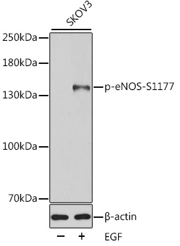 Anti-Phospho-eNOS-S1177 Antibody (CABP0515)