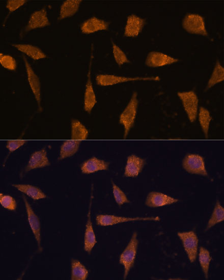 Anti-TXNRD1 Antibody (CAB16631)