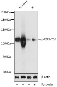 Anti-Phospho-EEF2-T56 pAb (CABP0832)