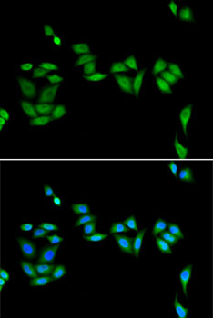 Anti-JADE1 Antibody (CAB12579)