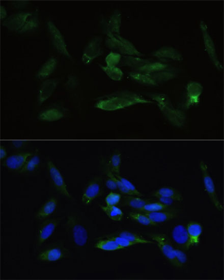 Anti-TGFBR2 Antibody (CAB11788)