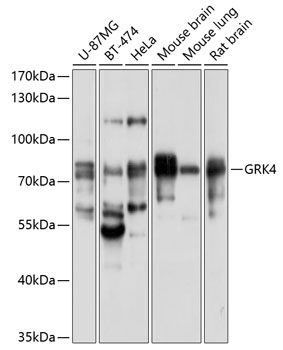 Anti-GRK4 Antibody (CAB10370)