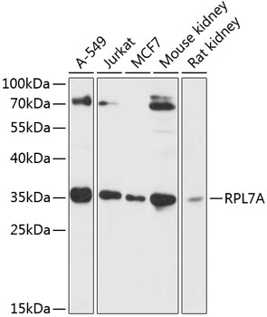 Anti-RPL7A Antibody (CAB14060)