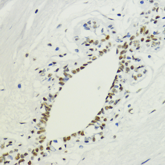 Anti-DiMethyl-Histone H3-K36 Antibody (CAB2365)