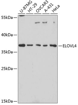 Anti-ELOVL4 Antibody (CAB3639)